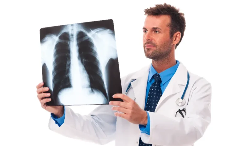 X-Ray